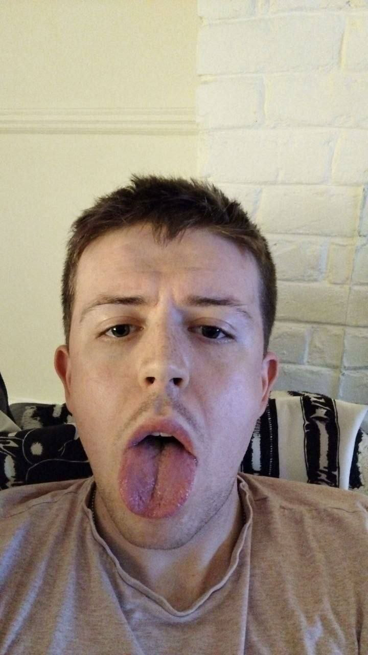 EXPOSED FAGGOT @g493827